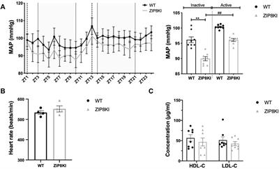 The Allelic Variant A391T of Metal Ion Transporter ZIP8 (SLC39A8) Leads to Hypotension and Enhanced Insulin Resistance